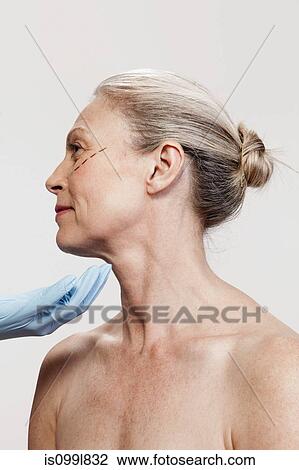 Mature woman with cosmetic surgery marking View Large Photo Image Stock Image - Mature woman with cosmetic surgery marking. Fotosearch