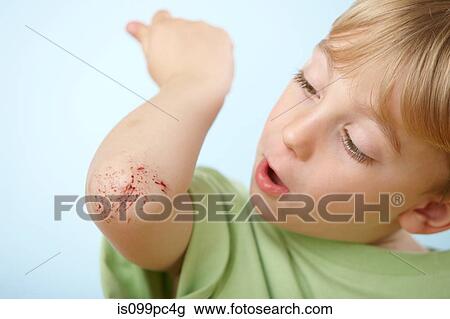 Stock Image - Boy with grazed elbow. Fotosearch