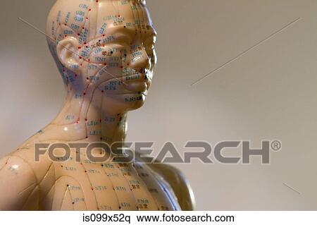 Stock Photography - Acupuncture model. Fotosearch