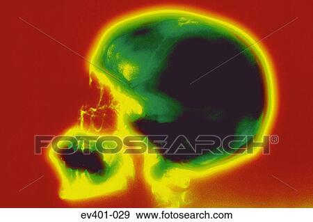 Brain scan View Large Photo Image Stock Photo - Brain scan. Fotosearch
