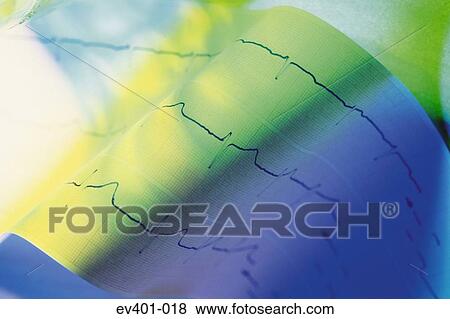 Stock Photo - ECG. Fotosearch