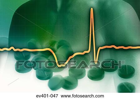 Stock Photo - Heart trace. Fotosearch