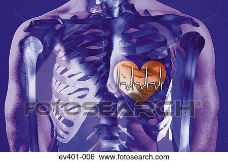Heartbeat View Large Photo Image Stock Photograph - Heartbeat. Fotosearch