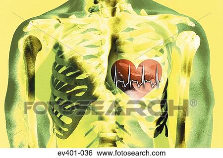 Stock Photograph - Heartbeat. Fotosearch