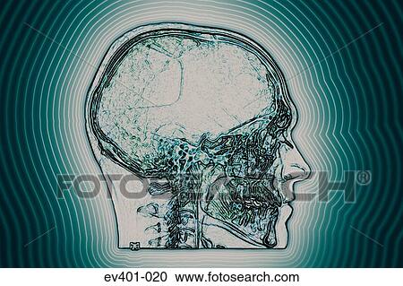 Stock Image - Human brain. Fotosearch