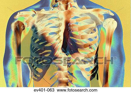 Skeleton View Large Photo Image Stock Image - Skeleton. Fotosearch