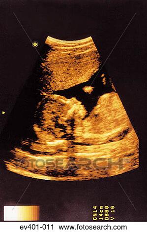 Ultrasound scan View Large Photo Image Stock Image - Ultrasound scan. Fotosearch