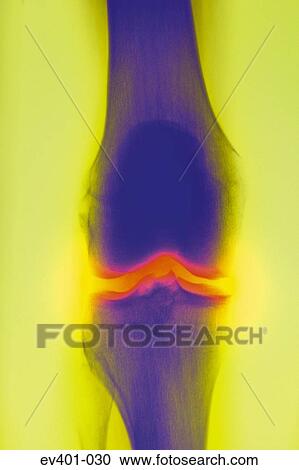 X-ray View Large Photo Image Stock Image - X-ray. Fotosearch