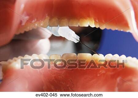 Dental operation View Large Photo Image Stock Photography - Dental operation. Fotosearch