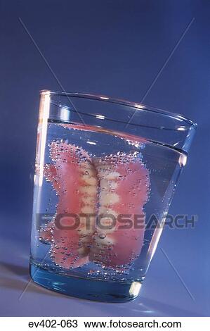 Dentures View Large Photo Image Stock Image - Dentures. Fotosearch