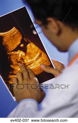 Doctor checking scan View Large Photo Image Stock Photo - Doctor checking scan. Fotosearch