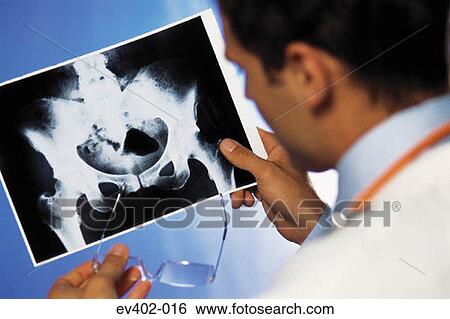 Stock Photograph - Doctor checking x-ray. Fotosearch