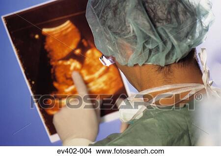 Picture - Surgeon checking scan. Fotosearch