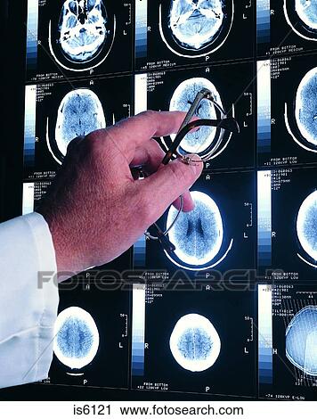 Stock Image - Brain scans. Fotosearch