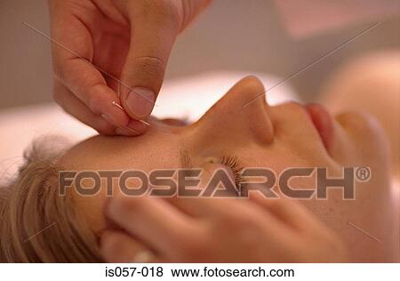 Acupuncture View Large Photo Image Stock Photo - Acupuncture. Fotosearch