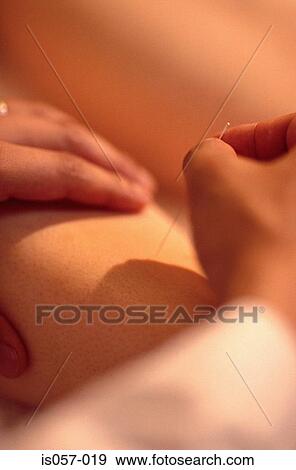 Acupuncture View Large Photo Image Stock Photo - Acupuncture. Fotosearch