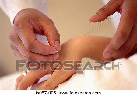 Acupuncture View Large Photo Image Stock Photography - Acupuncture. Fotosearch
