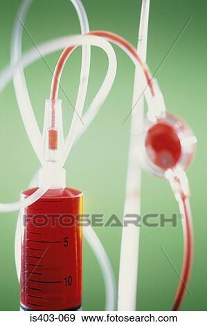 Stock Photo - Blood transfusion. Fotosearch
