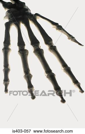 Skeletal hand View Large Photo Image Stock Photo - Skeletal hand. Fotosearch