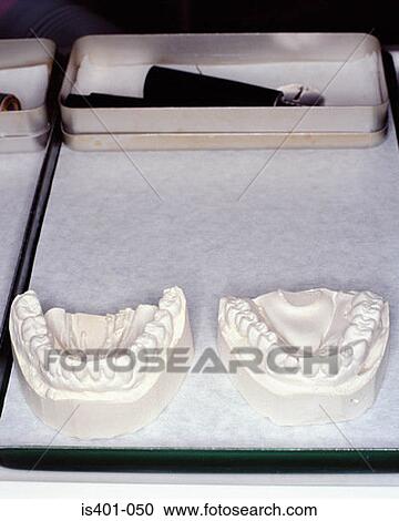 Plaster cast teeth View Large Photo Image Stock Image - Plaster cast teeth. Fotosearch