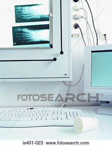 X-rays and computer View Large Photo Image Stock Image - X-rays and computer. Fotosearch