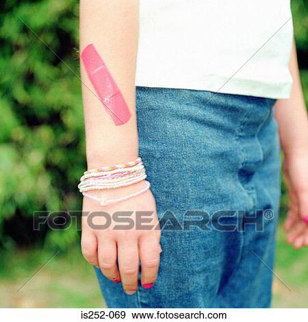 Stock Photo - Arm with plaster. Fotosearch