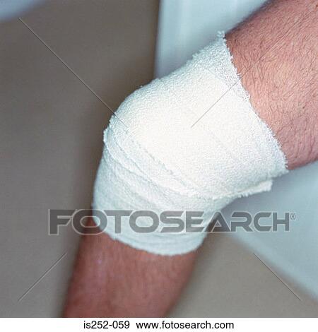 Injured leg View Large Photo Image Stock Photo - Injured leg. Fotosearch