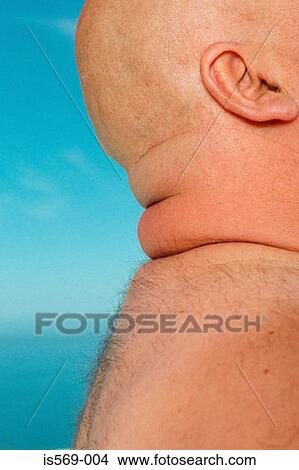 Overweight man View Large Photo Image Picture - Overweight man. Fotosearch