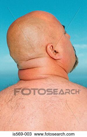 Overweight man View Large Photo Image Stock Image - Overweight man. Fotosearch
