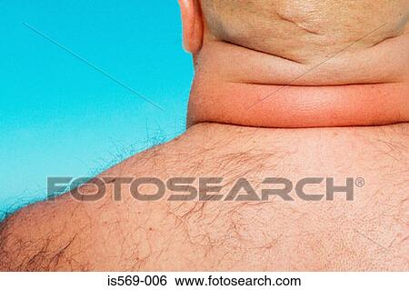 Overweight man View Large Photo Image Stock Photograph - Overweight man. Fotosearch