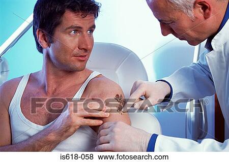 Man having tattoo removed View Large Photo Image Stock Photo - Man having tattoo removed. Fotosearch