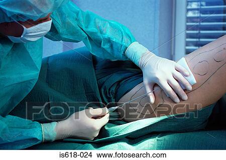 Picture - Woman having liposuction. Fotosearch