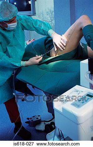 Woman having liposuction View Large Photo Image Stock Photo - Woman having liposuction. Fotosearch