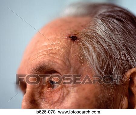 Stock Photo - Close-up of elderly man's head. Fotosearch