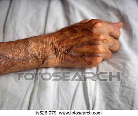 Elderly arm View Large Photo Image Stock Photo - Elderly arm . Fotosearch