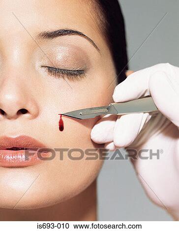 Stock Image - Woman having a face lift. Fotosearch