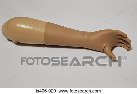 Stock Image - Myoelectric hand. Fotosearch