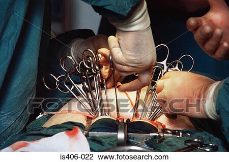 Surgeons performing a hysterectomy View Large Photo Image Stock Image - Surgeons performing a hysterectomy. Fotosearch