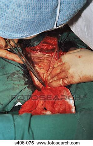 Stock Photography - Surgeons performing operation. Fotosearch