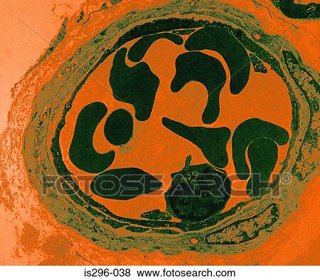 Blood vessel View Large Photo Image Stock Photo - Blood vessel. Fotosearch