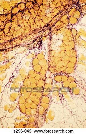 Stock Image - Blood vessels in omentum. Fotosearch