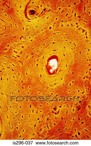 Stock Photo - Cavities in bone. Fotosearch