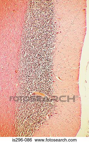 Cerebellum View Large Photo Image Stock Photograph - Cerebellum. Fotosearch