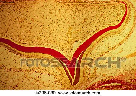 Developing tooth View Large Photo Image Stock Image - Developing tooth. Fotosearch