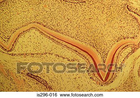 Stock Photograph - Developing tooth. Fotosearch