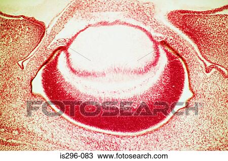 Foetal eye View Large Photo Image Stock Image - Foetal eye. Fotosearch