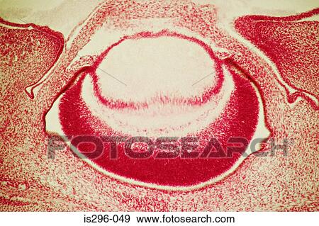 Foetal eye View Large Photo Image Stock Photo - Foetal eye. Fotosearch