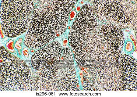 Foetal thymus View Large Photo Image Stock Image - Foetal thymus. Fotosearch