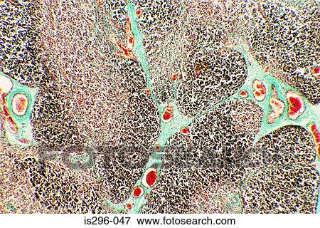 Foetal thymus View Large Photo Image Stock Photo - Foetal thymus. Fotosearch