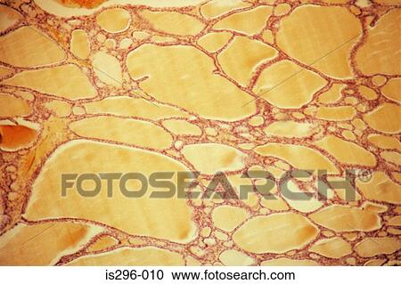 Follicles of colloid in the thyroid View Large Photo Image Stock Image - Follicles of colloid in the thyroid. Fotosearch